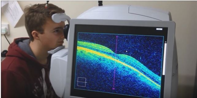 New technique for early detection of human eye diseases