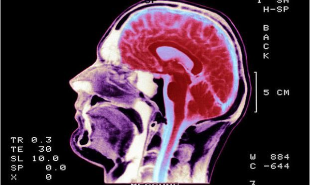 Brain scans to predict if kid is at drug abuse risk