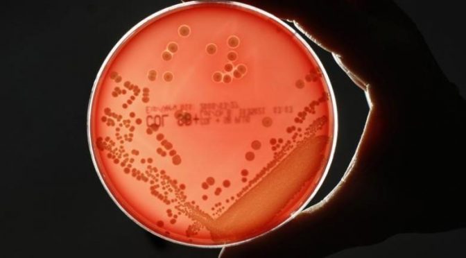 U.S.-UK alliance targets the world’s deadliest superbugs
